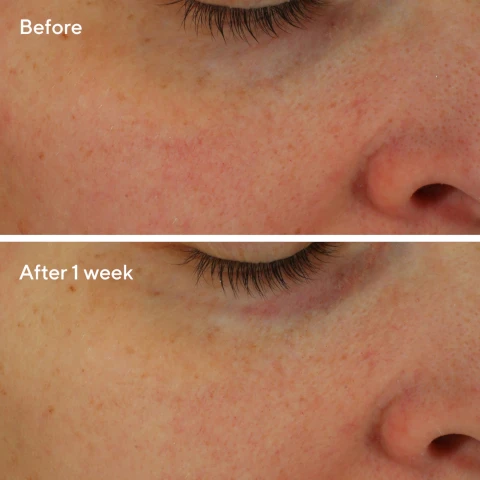 Image 1, before after 1 week Image 2, IMMEDIATELYSMOOTHS+ PLUMPS*Intensely hydrates for24 HOURS*Strengthens barrierIN JUST 1 USEWorks layers deep to smooth and plump skin*tested after 4 weeks of continuous useMurad.Crème restauratrice hydro-hyaluron Restorative Hydro-Hyaluronic Cream with multi-molecular intense hydration avec hydratation intense multimoléculaireMurad.avec hydratation intense multimoléculaire with multi-molecular intense hydration estauratrice hydro-hyaluronique tive Hydro-Hyaluronic Cream