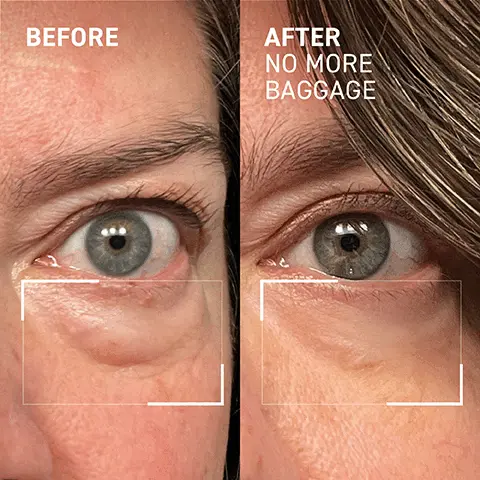 Image 1 - Image shows a comparison of two close-up shots of eyes labeled BEFORE on the left and AFTER NO MORE BAGGAGE on the right, highlighting a reduction in puffiness and dark circles under the eye on the right side.
Image 2 - A close-up image showing two side-by-side photos of an eye area; the left side labeled Before shows noticeable wrinkles and bags under the eye, while the right side labeled NO MORE BAGGAGE AFTER 1 USE appears smoother and less puffy.
Image 3 - A smiling woman lightly touching her face, with text stating 97% showed an improvement in the appearance of under eye bags and puffiness after 5 minutes, and a note at the bottom indicating *Self-assessment test conducted on 30 volunteers.
Image 4 - A woman with wavy hair is shown with her eyes closed and a serene expression, gently touching the skin under her eye; visible text on the left states NO SLEEP? NO PROBLEM! followed by three bullet points: Reduces the look of bags under-eyes, Restores the look of elasticity, and Brightens under-eye area.
Image 5 - A step-by-step guide on how to apply a skincare product, including four numbered steps: Step 1 shows a person applying moisturizer around the eyes, Step 2 emphasizes warming product between fingers, Step 3 advises to pat product under the eyes without rubbing, and Step 4 mentions reapplying every 6-8 hours with individual results varying.
Image 6 - A tube of dr. brandt eye cream is partially squeezed, revealing a line of the product, with icons indicating it is synthetic fragrance free, sulfate free, paraben free, and cruelty free.
Image 7 - Image showing a skincare routine with five steps: cleanse, exfoliate, treat, moisturize, and prime, with step 5 highlighted as PRIME, and instructions on how to apply it and when to use it.