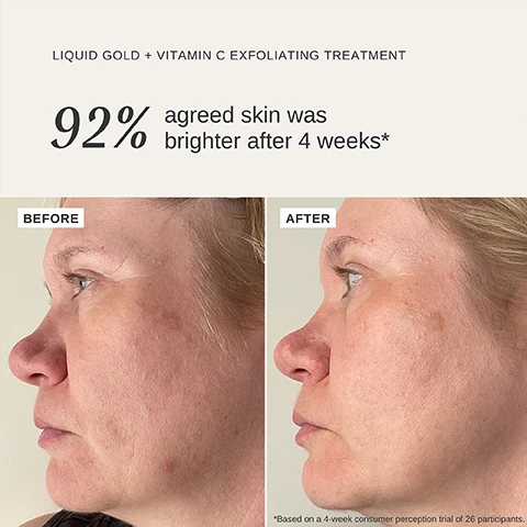 LIQUID GOLD + VITAMIN C EXFOLIATING TREATMENT92%agreed skin wasbrighter after 4 weeks*BEFOREAFTER*Based on a 4-week consumer perception trial of 26 participants. Image 2, GLYCOLIC ACID Brightens, evens tone and promotes collagen productionALPHAHTAZMAN PEPPERHelps soothe and calm rednessVITAMIN CSupports skin radiance andprotects againstenvironmentalstressorsLIQUID GOLDTM VITAMIN CEXFOLIATING TREATMENT WITH 5% GLYCOLIC ACID100 mL/3.38 fl.oz.SILK PROTEINSMoisture bindingproteins thatsupport hydration Image 3, 92%AGREED SKIN WAS BRIGHTER AFTER 4 WEEKS85%NOTICED MORE RADIANT SKIN OVERNIGHTALPHA-H81%SAW AN IMPROVEMENT TO SKIN TONE AFTER 4 WEEKSLIQUID GOLDTMM +VITAMINEXFOLIATING TREATMENT WITH 5% GLYCOLIC ACID100 mL/3.38 fl.oz.*Based on a 4-week consumer perception trial of 26 participants.