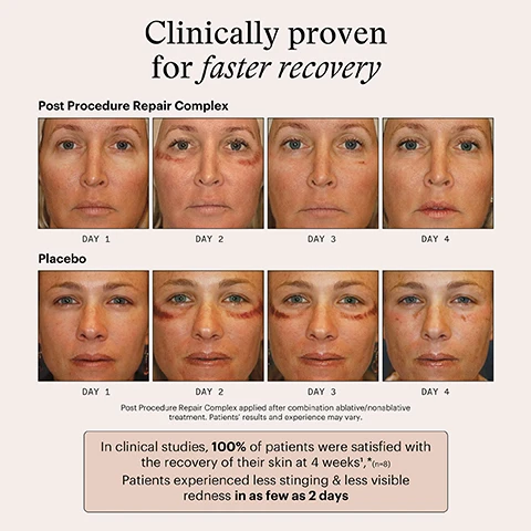 Image 1 - A comparison of two sets of images showing facial treatment results over four days, with one set labeled Post Procedure Repair Complex and the other labeled Placebo; the images depict the progression of skin recovery and improvement over time, with text below stating clinical study results.Image 2 - A silver skincare product is positioned against a neutral background, with the text Cutting-Edge Recovery above it; the product label reads SkinMedica Post Procedure Repair Complex, and additional text highlights its support for skin preparation and recovery before and after procedures.
Image 3 - A skincare product bottle labeled Post Procedure Repair Complex by SkinMedica, featuring a silver cap and a description that highlights key ingredients: MRCx™ for skin recovery, Aloe Leaf Juice for hydration, and Pyrrolidone Carboxylate (PCA) for skin nourishment.
