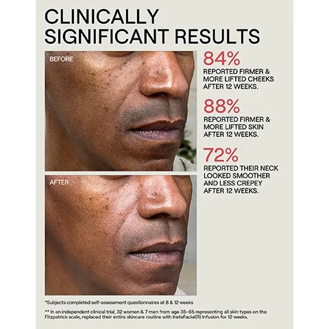 Image 1 - Image shows a before-and-after comparison of a males face, highlighting improvements in skin firmness and appearance. Visible text includes CLINICALLY SIGNIFICANT RESULTS, 84% REPORTED FIRMER & MORE LIFTED CHEEKS AFTER 12 WEEKS, 88% REPORTED FIRMER & MORE LIFTED SKIN AFTER 12 WEEKS, 72% REPORTED THEIR NECK LOOKED SMOOTHER AND LESS CREPEY AFTER 12 WEEKS, and additional notes about subjects in clinical trials.