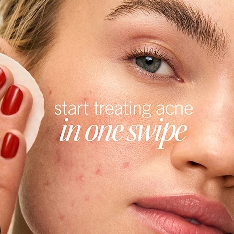 Image 1 - Close-up of a womans face with acne, with a hand holding a cotton pad nearby, showing the text start treating acne in one swipe. Image 2 - Before and after comparison of skin showing reduced redness and acne scarring with the text BEFORE AFTER 4 WEEKS Real skin real results and visibly improves overall skin texture. Image 3 - Before and after comparison of a cheek with acne with text BEFORE, AFTER 1 WEEK, and Real skin, real results. Image 4 - Close-up of a pink container of cotton pads with water droplets, showing the text INGREDIENT SPOTLIGHT 2% Salicylic Acid to treat + help prevent breakouts without stripping skin SENSITIVE SKIN PEAUX SENSIBLES ACNE CLEARING PADS 2% Salicylic Acid Acne Treatment. Image 5 - A close-up shows white cotton pads with the text 100% compostable pad and a round green logo featuring the Earth and the text 100% COMPOSTABLE. Image 6 - Close-up of a persons face with acne marks and a hand holding a round pad, with text overlay stating 96% agree these pads helped clear up acne in 2 weeks* In a consumer perception study with 50 participants after 2 weeks. Image 7 - An image shows three First Aid Beauty products for a sensitive skin breakout routine with text sensitive skin breakout routine, featuring Pure Skin Face Cleanser STEP 1: cleanse, Acne Clearing Pads STEP 2: treat, and Daily Resurfacing Lotion STEP 3: fade. Image 8 - Close-up of a womans face holding a pink container of acne pads with the text designed for sensitive + acne-prone skin.
