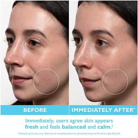 Image 1 - Side-by-side comparison of a womans face showing the before and after effects of a skincare treatment, with the left side labeled BEFORE and the right side labeled IMMEDIATELY AFTER*; visible text reads Immediately, users agree skin appears fresh and feels balanced and calm. Individual results may vary. Based on an immediate consumer perception study on 51 women ages 20 to 45.
Image 2 - A close-up of a textured blue surface with text highlighting benefits: Quick-absorbing hydration, Transforms to a matte finish, No shine or breakouts.
Image 3 - A jar of Peter Thomas Roth Water Drench Hyaluronic Jelly Moisturizer with a thick cream inside, sitting on a light blue platform, with text stating IMMEDIATELY Users agree skin appears less oily and pores look diminished* 48 HOURS OF ENHANCED HYDRATION* above and PETER THOMAS ROTH at the bottom.
Image 4 - A jar of Peter Thomas Roth Water Drench Hyaluronic Jelly Moisturizer is shown with a portion of the product spilling out, accompanied by icons indicating it is non-comedogenic, non-acnegenic, fragrance-free, and suitable for normal to oily skin, with visible text stating the products name and its features.
Image 5 - A woman smiles while holding a container of cream, with a light blue background featuring text that states CLINICALLY PROVEN to improve the skin barrier immediately and over time* IMMEDIATELY, USERS AGREE skin feels less irritated and appears less red†.
Image 6 - Three jars of skincare products from Peter Thomas Roth are displayed on a blue background: the top jar labeled Rich Cream, the middle jar labeled Original Cloud Cream, and the bottom jar labeled Weightless Jelly, each with descriptions of their uses and finishes.
Image 7 - A jar of Peter Thomas Roth Water Drench Hyaluronic Jelly Moisturizer with a light blue background features the text stating it contains 30% Hyaluronic Acid Complex, Aloe Vera & Citrus Water, and Hydrafence, with each ingredients benefit highlighted.