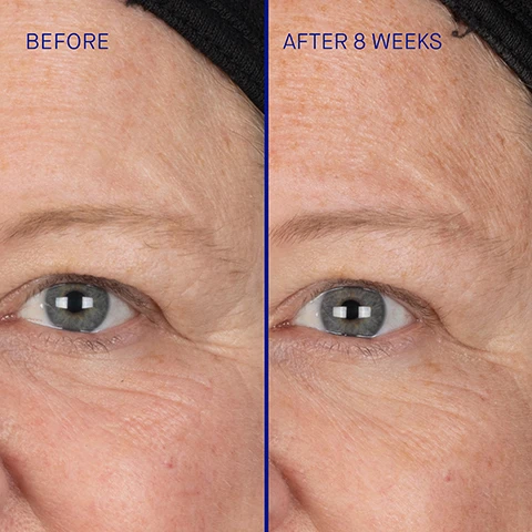 Image 1 - A split image shows a persons eye and skin area before and after 8 weeks with the left side labeled BEFORE and the right side labeled AFTER 8 WEEKS. Image 2 - A gold tube with decorative patterns is displayed next to a list of clinically proven results including Skin firmness improved by 32%, Fine lines reduced by 27% and crows feet reduced by 33%, Frown lines (11 lines) reduced by 28%, and Uneven pigmentation reduced by 81%. Image 3 - Close up of a womans face with text overlay that says User Proven Results 96% agree skin renewal was visibly accelerated 97% saw noticeable improvement in skin texture 95% agree skin looked firmer and more lifted 91% saw a visible reduction in fine lines and wrinkles. Image 4 - A gold and rose gold Augustinus Bader skincare bottle is shown next to text listing rapid cumulative results: Rapid Cumulative Results WITHIN TWO HOURS The Elixir helps protect and strengthen the skin barrier* AFTER ONE WEEK 100% of subjects showed improvement in uneven skin tone AFTER ONE MONTH 100% of subjects showed improvement in skin firmness and 98% agreed their skin looked overall healthier** AB Augustinus Bader. Image 5 - A gold Augustinus Bader serum bottle with a swipe of cream behind it is surrounded by text describing ingredients and benefits including ADVANCED TFC8 A proprietary complex that enhances skin renewal with a biomimetic nutrient delivery system EXCLUSIVE PHYTO-PEPTIDIC CONCENTRATE Exosome-rich concentrate that helps prevent visible signs of aging BIOMIMETIC ELASTIN Supports natural elastin and collagen production for firmer, lifted skin MARINE ALGAE ACTIVATOR Firms, smoothes, and brightens for a luminous glow Augustinus Bader AB THE ELIXIR WITH ADVANCED TFC8 LELIXIR AU TFC8 OPTIMISÉ 30ml e 1 fl.oz. Image 6 - Image shows a woman demonstrating skincare application with accompanying text steps: Step 1 Dispense 2 pumps into hand. In upward sweeping motions, smooth over the face, neck and decollete until fully absorbed Step 2 Follow by applying your Augustinus Bader moisturizer and eye cream. Image 7 - An image comparing The Serum and The Elixir skincare products showing their bottles and listing Key Ingredients Texture Key Benefits Key Concerns Ideal For, with text reading The Serum AB Augustinus Bader The Elixir AB Augustinus Bader Key Ingredients TFC8® | Edelweiss Extract | Polysaccharide Moisture Complex Texture Lightweight cream serum Key Benefits Firming & Hydrating Key Concerns Loss of elasticity, fine lines and wrinkles, skin barrier function, dryness, dullness Ideal For All skin types Key Ingredients Advanced TFC8® | Exclusive Phyto-Peptidic Concentrate | Biomimetic Elastin Texture Luxurious, silky serum Key Benefits Accelerated Renewal & Rapid Skin Lifting Key Concerns Skin cell health, wrinkles, loss of firmness and elasticity, sagging skin, uneven texture, dullness, dryness Ideal For Mature skin types. Image 8 - A split image compares a forehead before and after 15 days showing reduced lines. BEFORE AFTER 15 DAYS. Image 9 - Close-up view of skin near an eye showing a comparison before and after, with text BEFORE and AFTER 8 WEEKS.