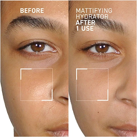 Image 1 - A close-up comparison of a persons face showing the left side labeled BEFORE and the right side labeled MATTIFYING HYDRATOR AFTER 1 USE, with a outlined section highlighting skin texture improvement.
Image 2 - A woman with a towel wrapped around her head gently touches her face, displaying healthy skin, with text that states 100% showed a more hydrated skin after 8 hours of application, and a note that says instrumental evaluation conducted on 30 volunteers.
Image 3 - A clear glass plate features two creamy white swatches of product, with text that reads Smart Sponge Technology absorbs oil without disturbing hydration levels and Blue Iris Extract protects skin while purifying and unclogging pores.
Image 4 - A white bottle with a silver cap labeled Dr. Brandt Mattifying Hydrator is displayed against a light purple background, surrounded by drops of water, with icons indicating it is synthetic fragrance free, paraben free, cruelty free, and sulfate free.