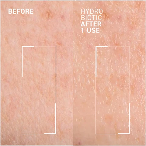Image 1 - Image showing a comparison of skin texture; the left side labeled BEFORE shows uneven skin, while the right side labeled HYDRO BIOTIC AFTER 1 USE displays smoother skin after treatment.
Image 2 - A woman holds a jar of Dr. Brandt Hydro Biotic skincare product while showing a natural makeup look, with text indicating that 100% of participants showed immediate skin hydration and 100% reported softer skin after four weeks.
Image 3 - A circular dish contains a pale green cream with labels indicating the benefits of its ingredients: ceramides strengthen skin barrier, fatty acids provide deep moisturizing, and biotic balancing complex pre- and post-biotics balance skin microbiome.
Image 4 - A jar of Dr. Brandt Hydro Biotic Prebiotic Recovery Sleeping Mask is shown against a green background, with a light green cream on top and graphic icons indicating that the product is synthetic fragrance-free, paraben-free, cruelty-free, and sulfate-free.