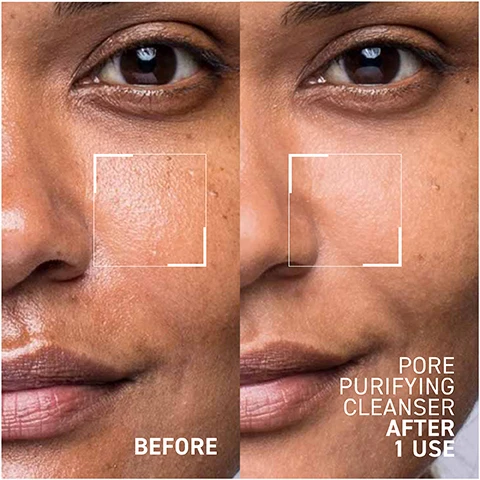Image 1 - A close-up of a womans face split into two halves, showing her skin before and after using a pore purifying cleanser, with BEFORE labeled on the left and PORE PURIFYING CLEANSER AFTER 1 USE on the right.
Image 2 - A light gray cream is shown in a clear circular dish, with labels indicating Salicylic Acid, which unclogs and refines pores, and White Willow Bark, which moisturizes, soothes, and improves cell regeneration.
Image 3 - A tube of Dr. Brandt Pore Purifying Cleanser is centered in a splash of light purple foam, with visible text on the tube that reads Dr. Brandt Integrative Dermatology Pore Purifying Cleanser.