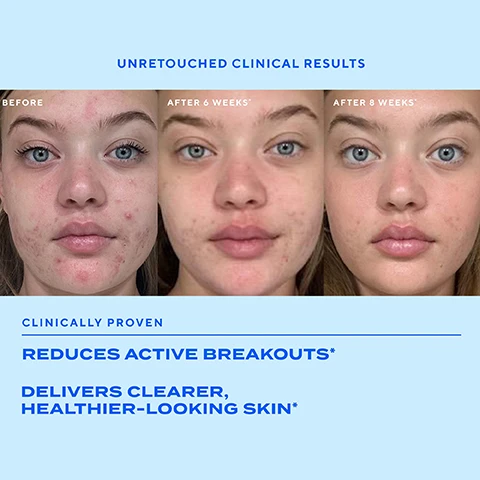 Image 1 - Image of a jar of Biossance Squalane + Omega Repair Cream with claims of 100% improvement in skin hydration after 5 minutes, 94% improvement in wrinkles in one week, and 97% agreement that skin appeared firmer, accompanied by badges for Best of the BUMP Awards and the National Eczema Association.
Image 2 - A side-by-side comparison of a persons cheek showing skin before treatment on the top labeled BEFORE and after 28 days of using the product on the bottom labeled AFTER 28 DAYS, with a jar of Squalane + Omega Repair Cream in the bottom right corner.
Image 3 - Image showing a side-by-side comparison of a womans face before and after using a skincare product for four weeks, with visible text stating 96% saw more lifted skin after 1 week and a note about the participant questionnaire from a clinical study.
Image 4 - A woman with curly hair gently touching her cheek is shown alongside text indicating that 100% saw more sculpted facial features in 1 week, 92% saw immediate improvement of fine lines and wrinkles, and 84% saw immediately firmer and lifted skin, with a note about the basis of these results.
