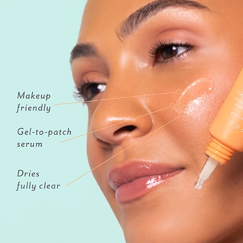 Image 1 - A close-up of a persons face showing a clear serum being applied to the cheek from an orange dropper bottle, with text callouts reading Makeup friendly, Gel-to-patch serum, Dries fully clear, and visible text on the bottle Clar, Patch, Toler, 20 mL | 0.6. Image 2 - A smiling young woman holds her hand up as if taking a selfie, with text that says: CLEAR SKIN, STAT. Treats, fades, & prevents breakouts 24/7. Image 3 - An image features two orange tubes of Patchology S.O.S. Totally Invisible Clarifying Liquid Patch, also labeled Patch Liquide Clarifiant Totalement Invisible, each 20 mL | 0.67 fl. oz. and batch number 25113, displayed on a light blue background alongside a list of benefits: Clears & prevents breakouts, Visibly fades dark spots, Refines bumpy skin texture, and Helps purify clogged pores. Image 4 - Four petri dishes on a light blue background contain a clear liquid labeled Tone-correcting Niacinamide, yellow powder labeled Purifying Sulfur, dried oat sprigs labeled Soothing Oat Extract, and dark amber pebbles labeled Exfoliating Succinic Acid. Image 5 - A 5-step skincare routine is displayed on a peach background with product smears, showing icons for each step: STEP 1: cleanse, STEP 2: serum, STEP 3: S.O.S, STEP 4: moisturizer, STEP 5: SPF/makeup; a central orange tube is labeled BATCH 25113, patchology, S.O.S., Totally Invisible Clarifying Liquid Patch, Patch Liquide Clarifiant Totalement Invisible, 20 ml / 0.67 fl. oz.