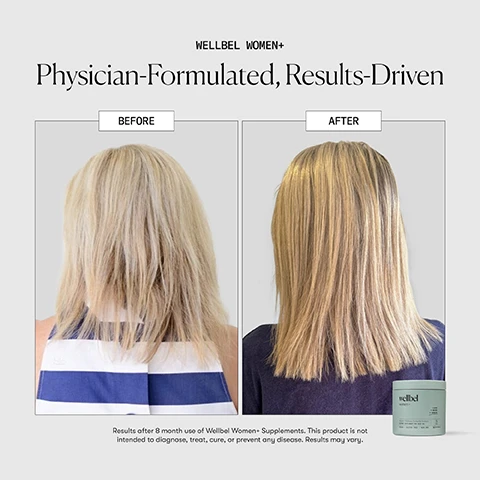 Image 10 - An advertisement for Wellbel Women+ shows three light green supplement containers on the right, with text on the left stating Wellbel Women+ RESULTS-DRIVEN. PHYSICIAN-FORMULATED. AFTER 6 MONTH USE:, followed by statistics 88% agree their hair appears longer, 94% agree their hair appears healthier, overall, and 83% agree hair appeared fuller with new hair growth, with a small asterisk referring to the disclaimer text *in an independent consumer panel conducted by Wellbel, Inc. with 192 participants after 6 month use of Wellbel supplements, and the wellbel logo at the bottom. Image 11 - A dark clip holds three light brown capsules vertically on a grey background, with text that reads WELLBEL WOMEN+ THE BENEFITS: + Balanced Dose of Biotin, + Hormone Health Balance, + Hair & Scalp Functionality, + Thinning Hair Nourishment, + Advanced Hair Growth Nutrition, + Collagen Production Boost, + Bone Health Essentials, + Antioxidant Protection, + Hair Vitality Support, and the wellbel logo is at the bottom right. Image 12 - A transparent tube holds numerous yellow-gold softgel capsules arranged in a spiral shape, next to the text What To Expect Month 1+ Take 3 vegan capsules once daily and let your hair health journey begin. Consistency is key, and most people start to see visible results within 90 days. Month 2+ You may notice early improvements in hair strength, clearer skin, and faster-growing nails. Our formula is supporting your body from within. Month 3+ The foundation built over the last two months is now showing on the surface. Expect healthier strands, less shedding, and an overall improved look and feel. Month 4+ What was once new growth is now stronger, more resilient hair with sustained density. You’re not just seeing change; you’re holding onto it. *These statements have not been evaluated by the Food and Drug Administration. This product is not intended to diagnose, treat, cure, or prevent any disease. Individual results may vary. Image 4 - A split image depicts a womans blonde hair from the back, showing a Before section with dry, messy hair and an After section with smooth, lustrous hair, with a green Wellbel Women+ supplement bottle visible, along with the text WELLBEL WOMEN+ Physician-Formulated, Results-Driven, Before, After, wellbel women+ HAIR + SKIN + NAILS Beauty Wellness. Backed by Science. DIETARY SUPPLEMENT FOR AGES 45+ VEGAN | GLUTEN FREE | NON-GMO 30 DAY SUPPLY 120 CAPSULES, and Results after 8 month use of Wellbel Women+ Supplements. This product is not intended to diagnose, treat, cure, or prevent any disease. Results may vary. Image 8 - A pile of light-colored, speckled powder is displayed on a light grey background, with text labels reading PHYSICIAN-FORMULATED Wellbel Women+, FUNCTIONAL MEDICINE PHYSICIAN-FORMULATED + RESULTS-DRIVEN, AGE-RELATED SUPPORT FOR HORMONAL CHANGES, and a list of ingredients including K2, MSM, BIOTIN, BETAINE HCl, SAW PALMETTO, COPPER, ZINC, along with the wellbel logo. Image 9 - A multi-panel image features an older woman with gray hair and a sage green wellbel women+ jar, showing some beige capsules floating above the jar, the jar filled with capsules, and the woman holding the jar near her face, with visible text on the jar including wellbel women+, Beauty + Wellness, DIETARY SUPP, POWERED BY SCIENCE, VEGAN | GLUTEN-FREE | NON-GMO, HAIR + SKIN + NAILS, 30 DAYS.