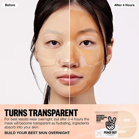 Image 1 - Split screen image shows a person wearing a face mask, with the left side labeled Before showing a translucent mask and the right side labeled After 4 Hours showing the mask becoming transparent, with text TURNS TRANSPARENT For best results wear overnight but after 3-4 hours the mask will become transparent as hydrating ingredients absorb into your skin BUILD YOUR BEST SKIN OVERNIGHT, and an image of the product packaging labeled OVERNIGHT BIO-COLLAGEN RECOVERY MASK PEACE OUT. Image 2 - A person wears a sheet mask on their face with text that reads BUILD YOUR BEST SKIN OVERNIGHT Boost Hydration Overnight Enhance Skins Radiance Revitalize Skin Barrier. Image 3 - Image showing three dishes with liquids representing ingredients against a pink background with text INGREDIENTS HYDROLYZED COLLAGEN Vegan collagen provides vibrant-looking skin. CORE PEPTIDE COMPLEX Blend of 5 peptides boosts moisture for firmer-looking, more hydrated skin. 8 HYALURONIC ACID BLEND Delivers intense hydration, helping to strengthen skin’s natural moisture barrier and visibly plump skin. Image 4 - A woman applies a sheet mask to her face while text reads HOW TO USE: 1. Apply as the final step in nighttime skincare routine. 2. Align with mouth and eyes, pressing gently onto the skin to adhere. 3. Wear for a minimum of 3-4 hours, or overnight for the best results. 4. Peel off mask in the morning and cleanse face as usual. Pro-Tip: Store the mask in the fridge for a cooling, soothing effect, perfect for calming tired or stressed skin. Image 5 - Diagram comparing skin before and after using a mask showing moisture loss versus retention with text HOW IT WORKS Before Overworked damaged skin After Wake up to a clearer-looking calmer more hydrated complexion and Peace Outs Bio-Collagen Recovery Mask uses vegan collagen to create a protective shield that seals in barrier-repairing ingredients This works to soothe your skin and lock in essential moisture preventing water loss for a replenished rejuvenated complexion. Image 6 - An image showing four steps of a skincare routine for acne-prone skin with product images and text THE EXPERTS IN ACNE PRONE SKIN TREAT ACNE + FIGHT DRYNESS A skincare recipe for clearer-looking, hydrated skin 1. CLEANSE DAILY ACNE CLARIFYING CLEANSER PEACE OUT ACNE GEL CLEANSER 2. TREAT ACNE CLARIFYING TREATMENT SERUM PEACE OUT ACNE SERUM 3. HYDRATE PEACE OUT ACNE GEL MOISTURIZER 4. REPAIR OVERNIGHT BIO-COLLAGEN RECOVERY MASK PEACE OUT PRO TIP: Salicylic Acid is a powerful active. We recommend starting this routine slowly and gradually increasing to 2x a day, based on your skin’s tolerance.