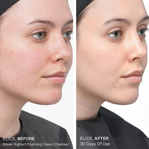 Image 3 - A before and after comparison of Elices face, showing her skin with redness and small blemishes on the left, and visibly clearer skin on the right after using a product, with visible text Elice, Before Greek Yoghurt Foaming Cream Cleanser and Elice, After 30 Days Of Use. Image 4 - A person with dark skin applies a creamy product to their face, looking slightly upwards with a blue sky background, and text reads: More than just a facewash: + Removes makeup + Locks in hydration + Deeply cleans pores + Reduces redness. Image 5 - A white tube of KORRES skincare product with a dark blue label is shown on a wooden background, featuring text KORRES GREEK YOGHURT Foaming Cream Cleanser PRE + PROBIOTICS YOGOURT GREC Crème Nettoyante Moussante PRÉ + PROBIOTIQUES GREEK YOGHURT Αφρώδης Κρέμα Καθαρισμού PRE + PROBIOTICS e 150 mL / 5.07 FL. OZ., and on the left, three statistical claims: 100% said skin felt fresh, revitalized, and smooth immediately after use, 100% saw more moisturized, healthy-looking skin immediately after use, and 97% saw reduced skin redness and improved skin texture immediately after use. Image 14 - A woman with her eyes closed applies cream to her cheek, demonstrating product benefits where 100% saw improvement in skin moisture & softness after one use, 91% saw more balanced, comforted & stronger looking skin after one use, and 91% saw improvement in skins overall appearance after one use, according to a third party consumer perception study with 32 participants. Image 15 - A persons hands are shown, with one finger dipping into a white jar of KORRES Greek Yoghurt Nourishing Probiotic Gel-Cream, and overlay text on the image reads Super-Feed Your Skin: + 48 hour ultra hydration + Calms sensitive skin + Reduces redness & dryness + Softens signs of aging, while the jars label also states MICROBIOME TECHNOLOGY and REPLENISH + BOUNCE. Image 16 - A young woman with blue eyes applies white cream to her face, with several dabs visible on her forehead, cheeks, and chin, and the visible text Greek Yoghurt KORRES.