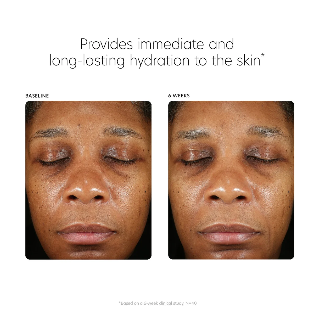 PCA SKIN Hyaluronic Acid Boosting Serum (1 oz.)