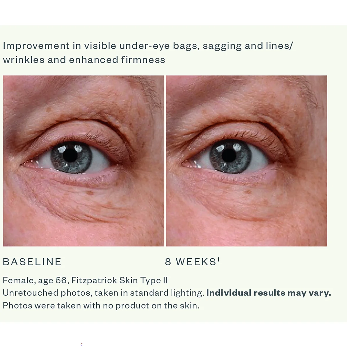 SkinMedica Instant Bright Eye Cream