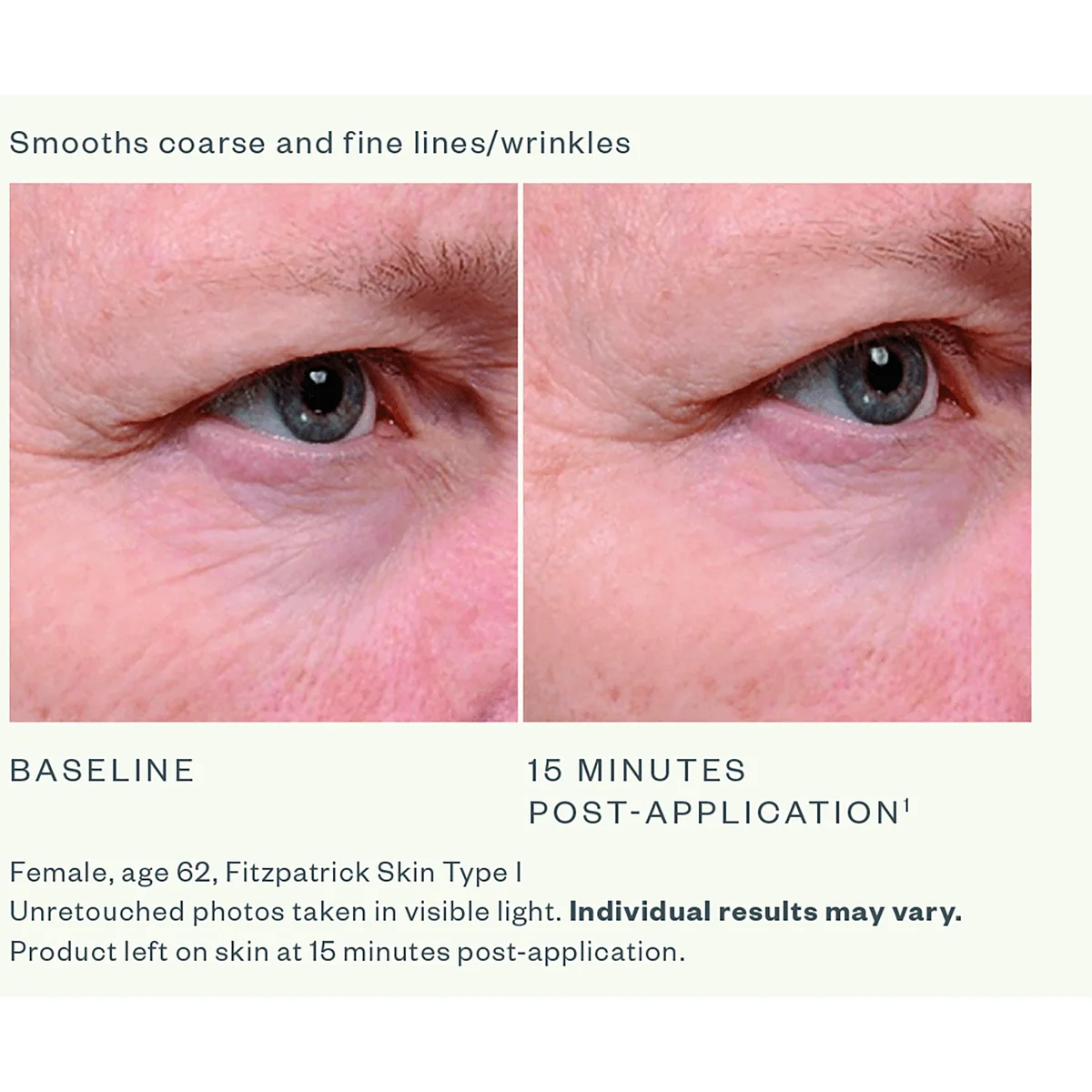 SkinMedica Instant Bright Eye Cream