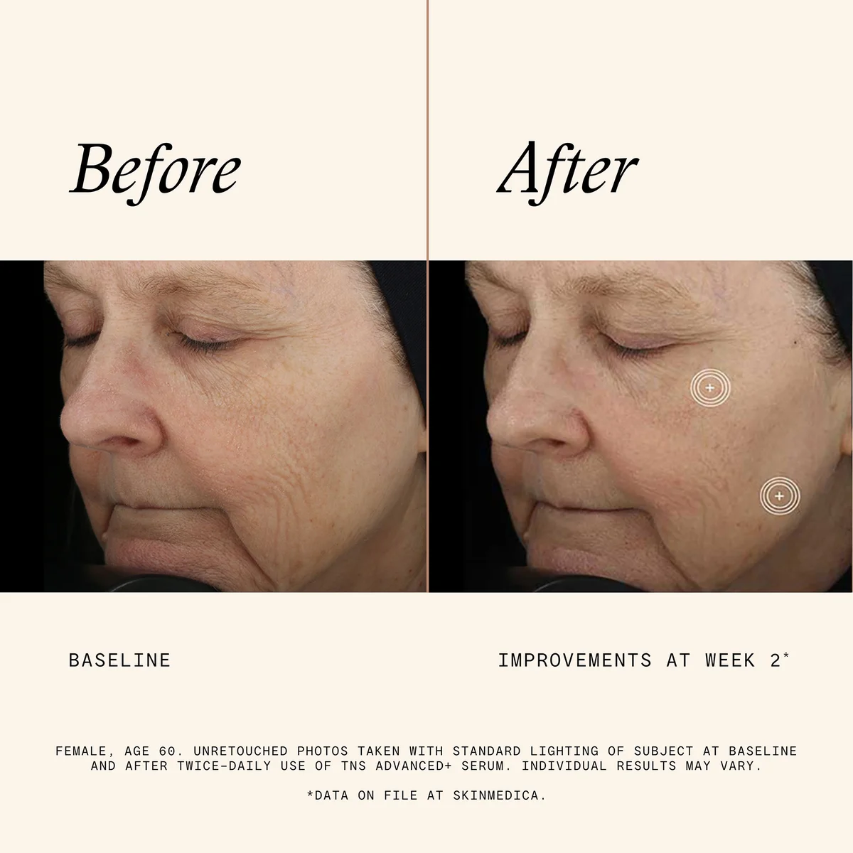 SkinMedica TNS Advanced+ Serum Bundle - Buy 2 Get 1 Free