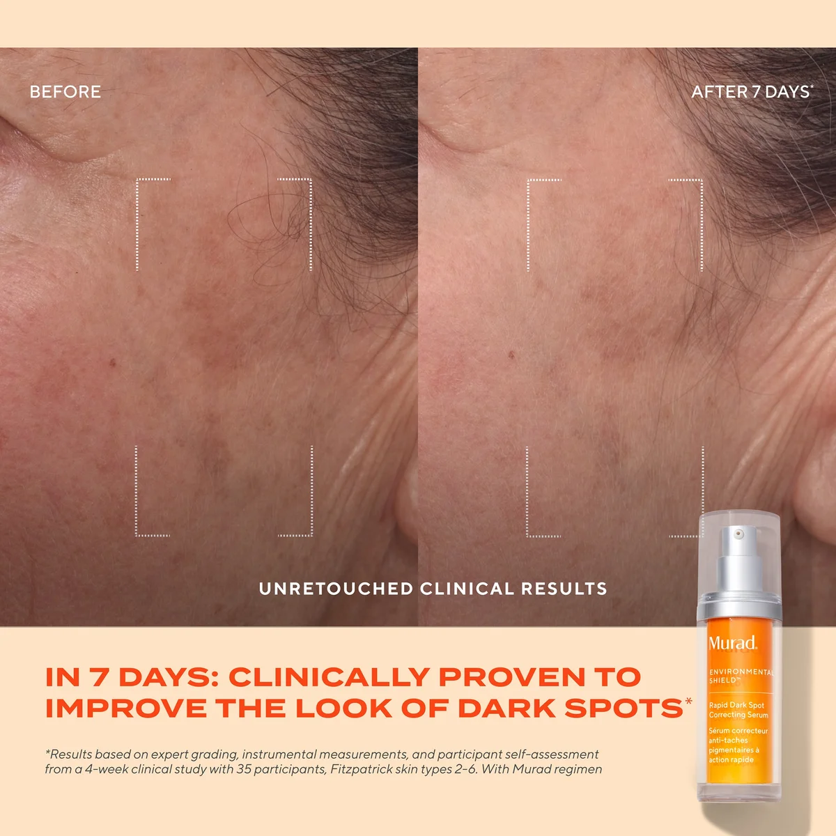 Murad Rapid Dark Spot Correcting Serum 1 oz