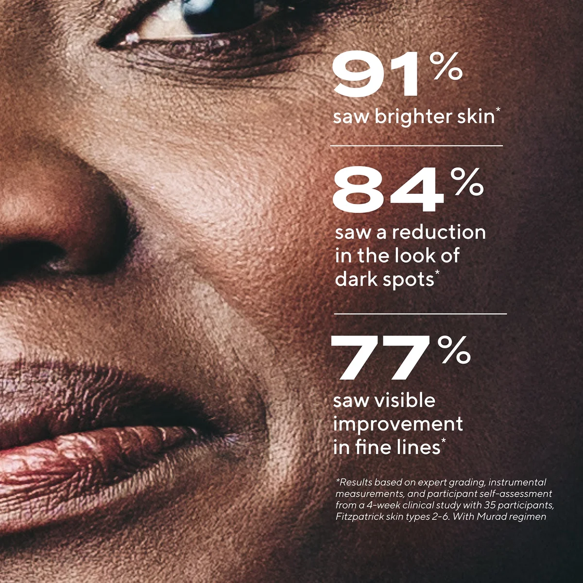 Murad Rapid Dark Spot Correcting Serum 1 oz