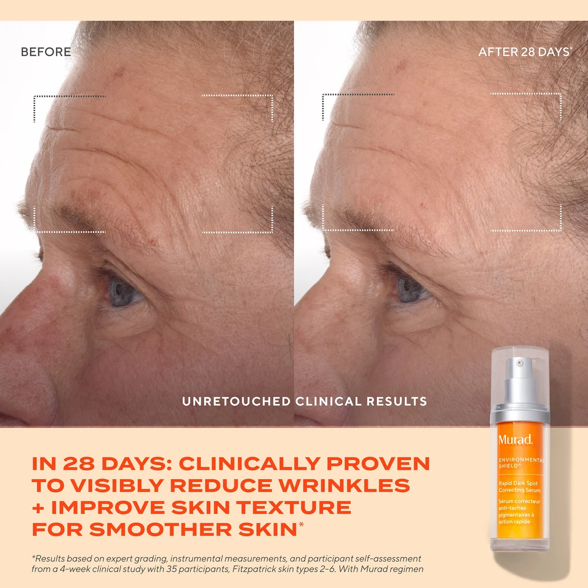 Murad Rapid Dark Spot Correcting Serum 1 oz