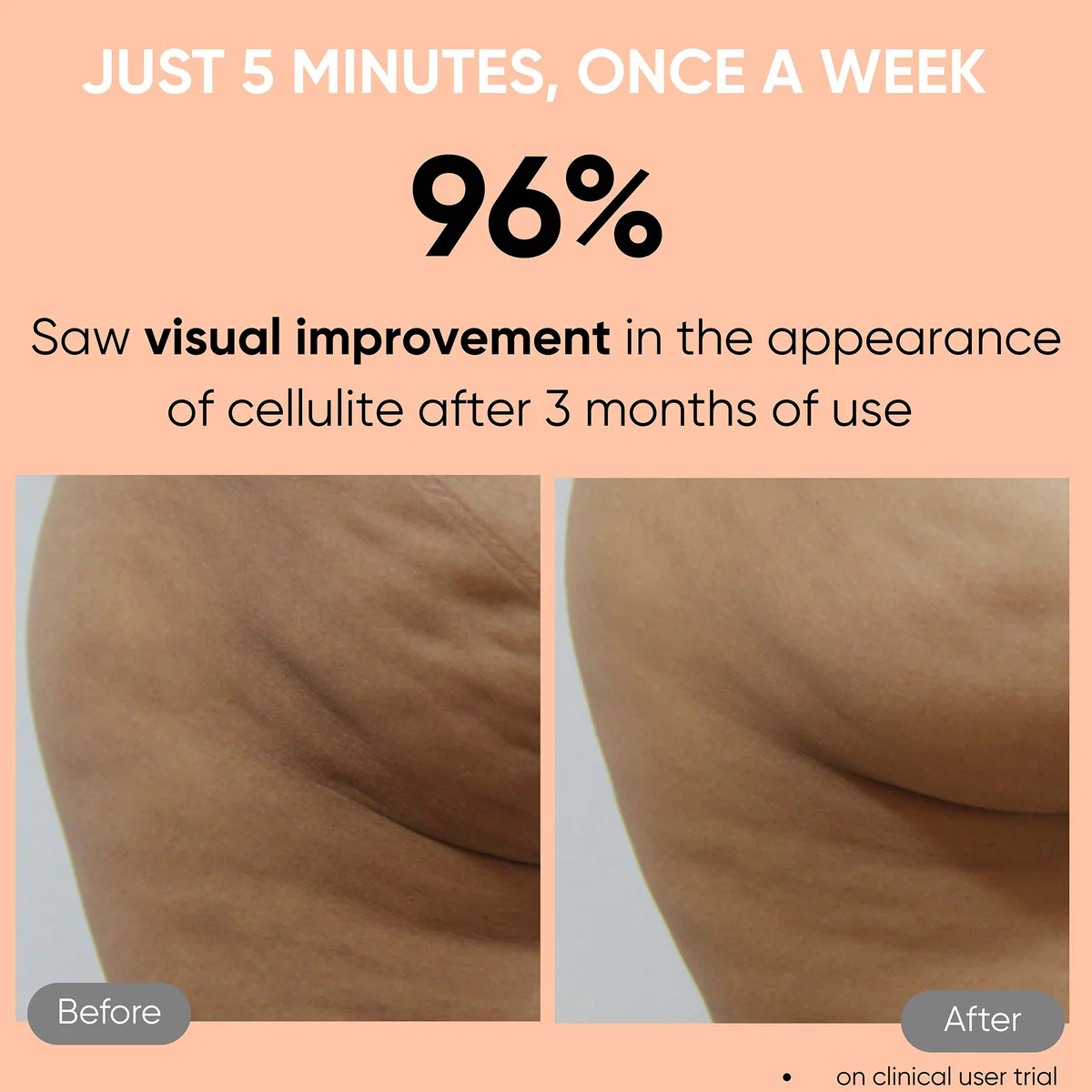 Sensica Sensifirm