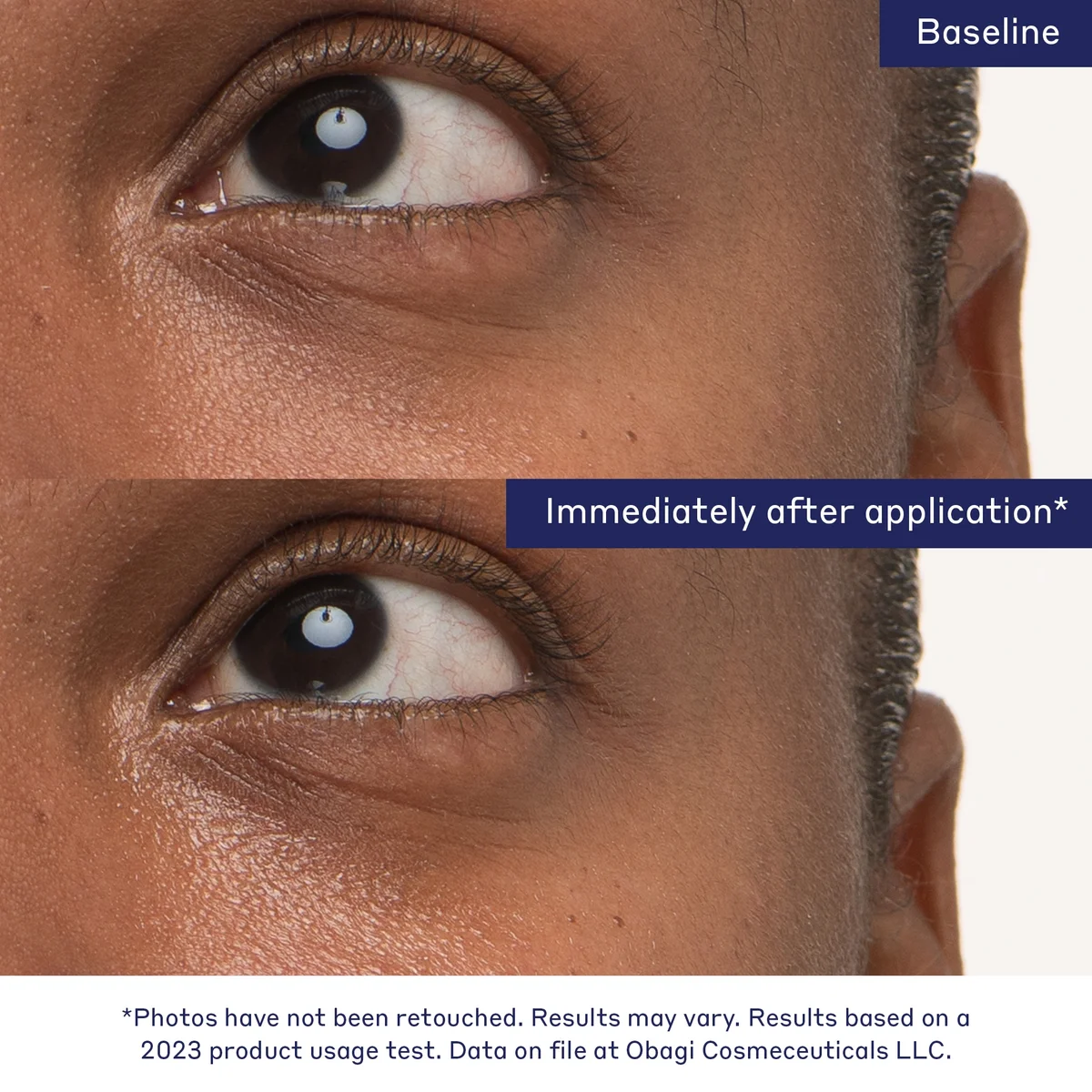 Obagi Medical Daily Hydro-Drops Rejuvenating Eye Gel Cream 15ml