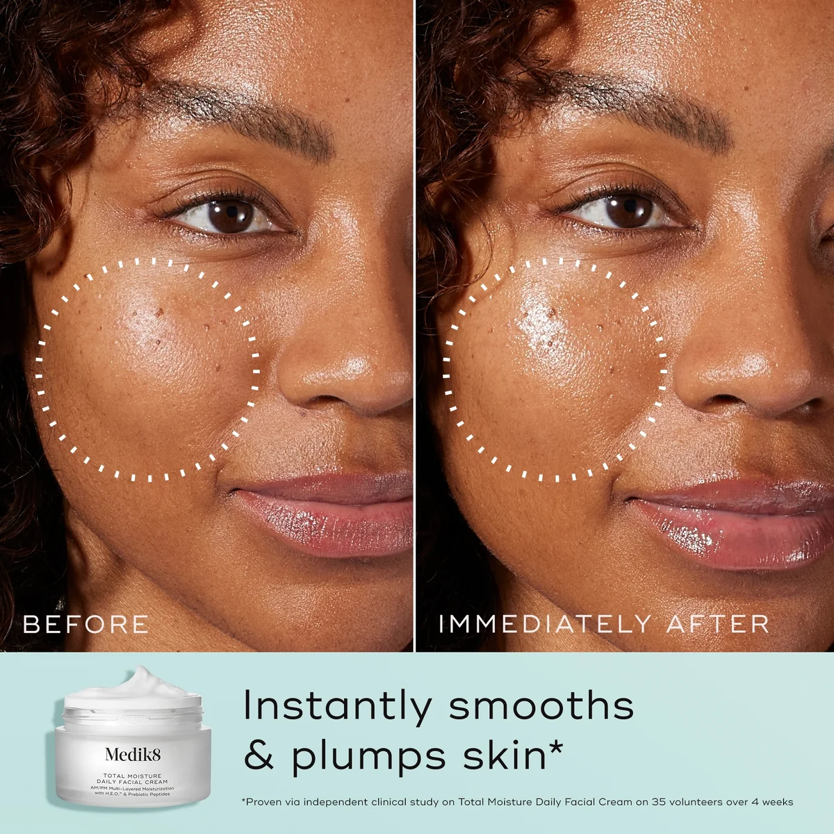 Medik8 Total Moisture Daily Facial Cream 48g