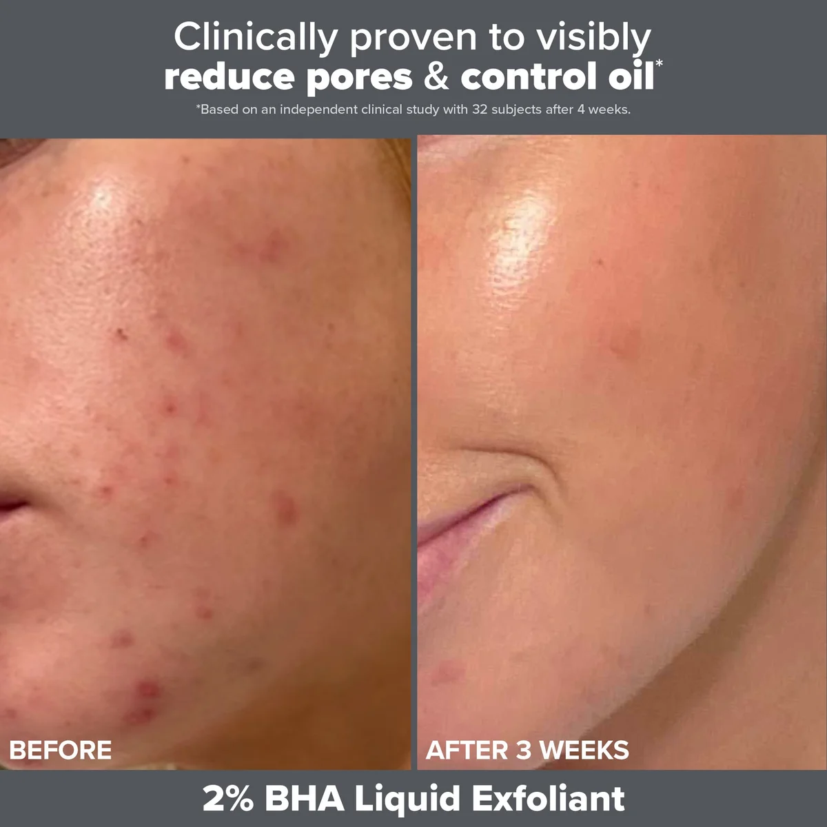 Paula's Choice The Exfoliation Experience 2oz (Worth $29)