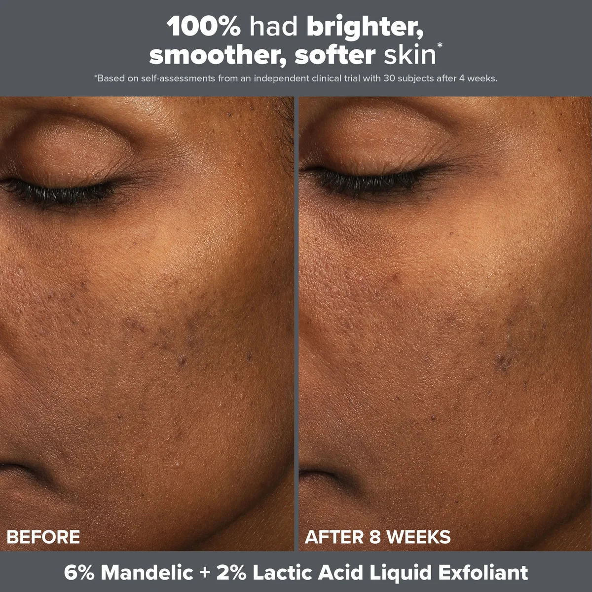 Paula's Choice The Exfoliation Experience 2oz (Worth $29)