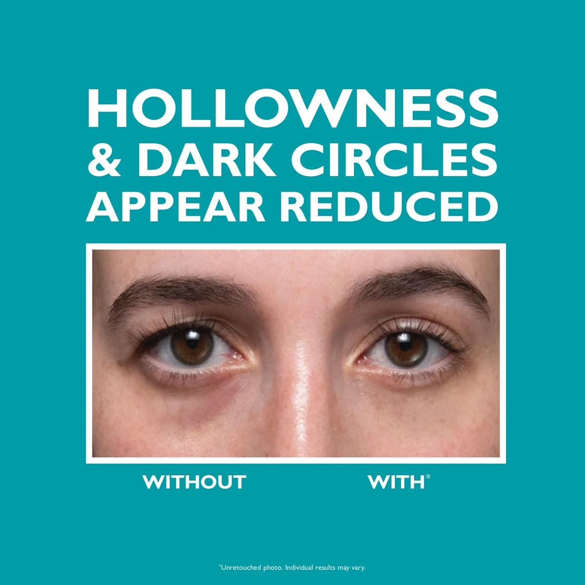 Peter Thomas Roth Peptide Skinjection Fill + Fix Under-Eye Cream 15ml