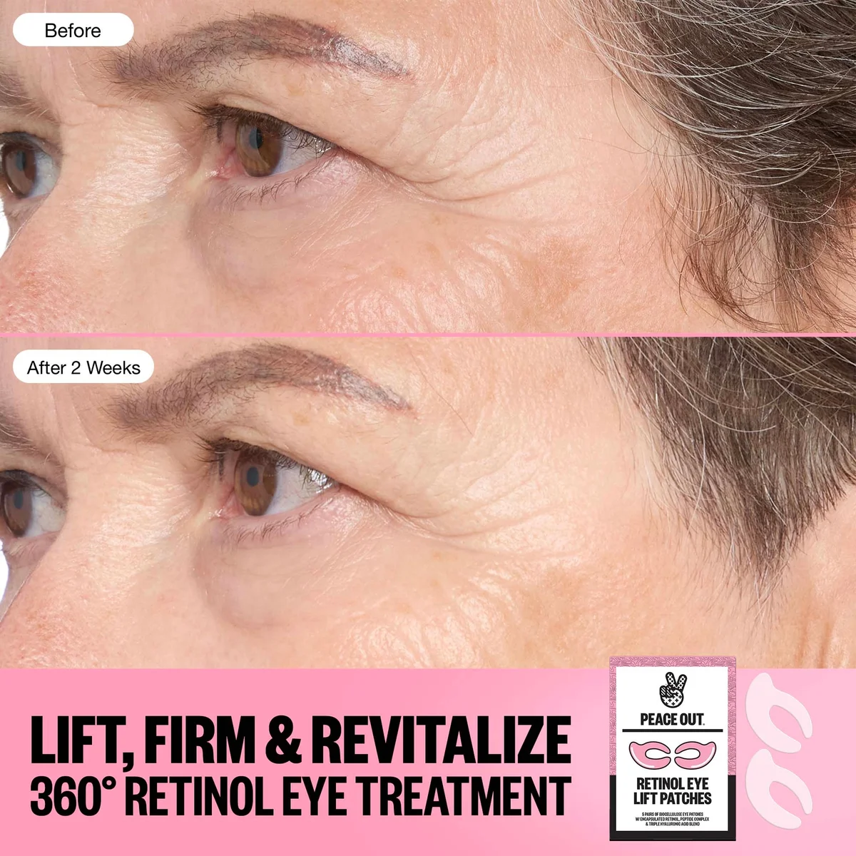 Peace Out Retinol 360° Eye Lift Patches to Lift, Firm and Revitalize Eyes (5 Pairs)