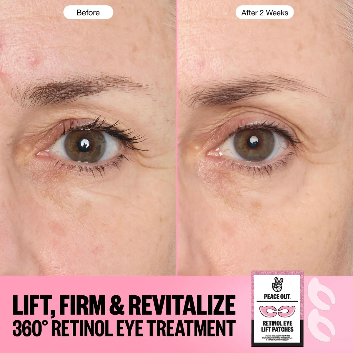 Peace Out Retinol 360° Eye Lift Patches to Lift, Firm and Revitalize Eyes (5 Pairs)