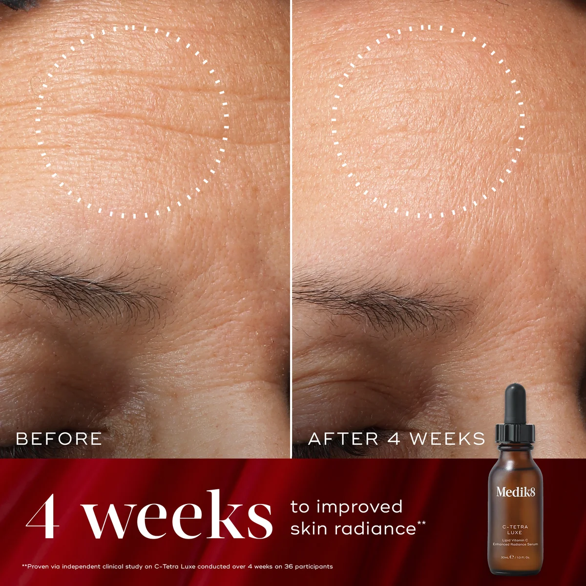 Medik8 Radiance Wrapped Kit (Worth $118.00)