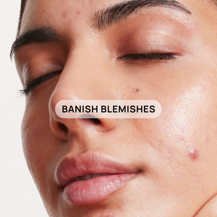 Treat and prevent acne,
once and for all.