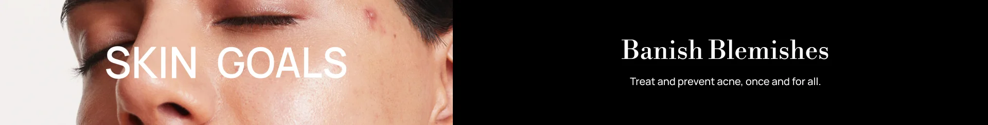 Skin Goals: Banish Blemishes
