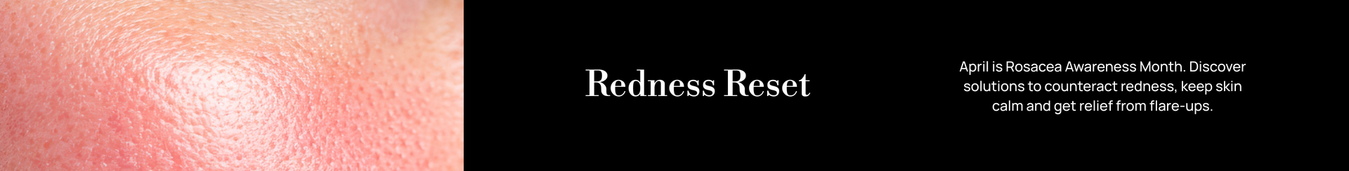 Skin Goals: Reduce Redness